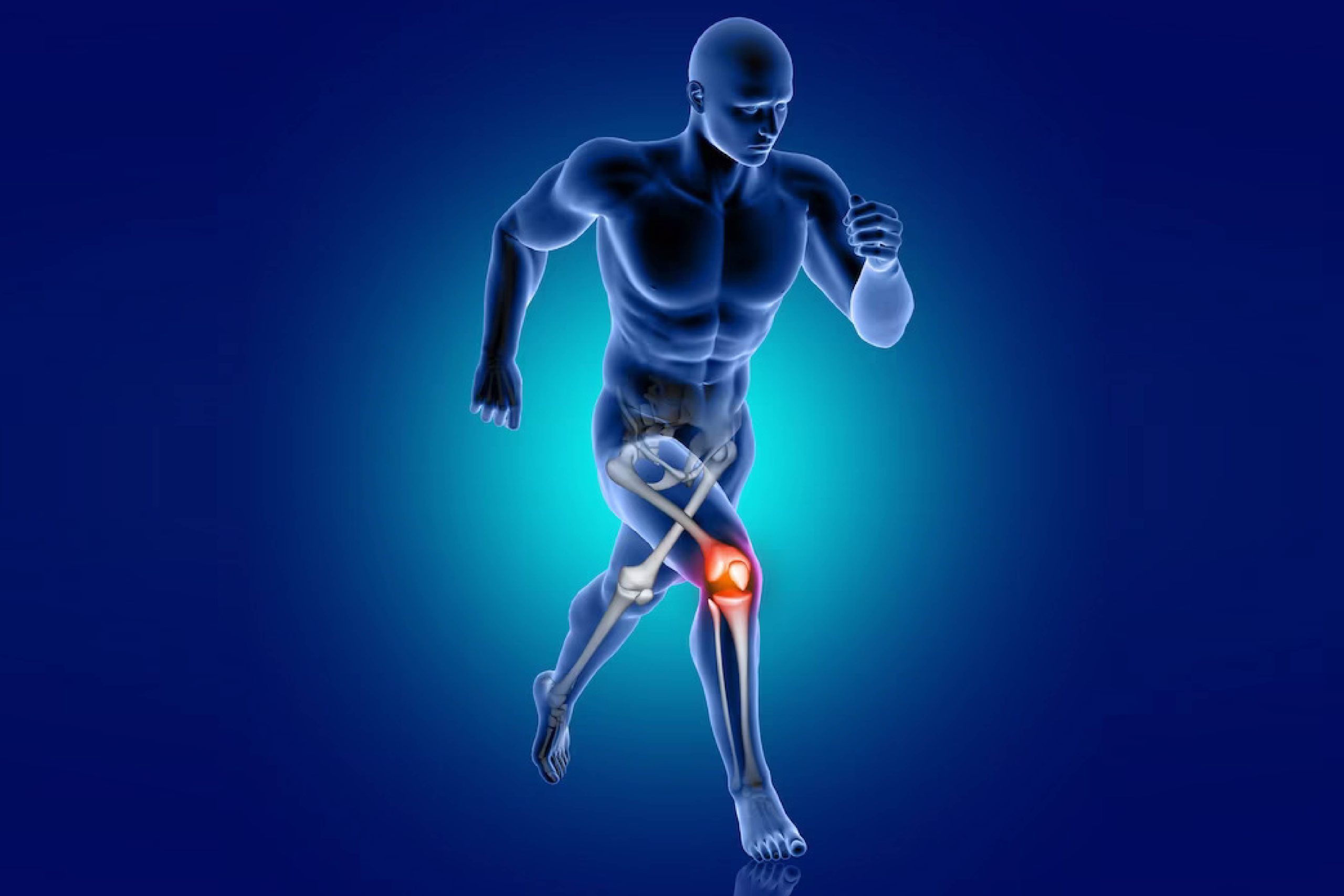Arthritis