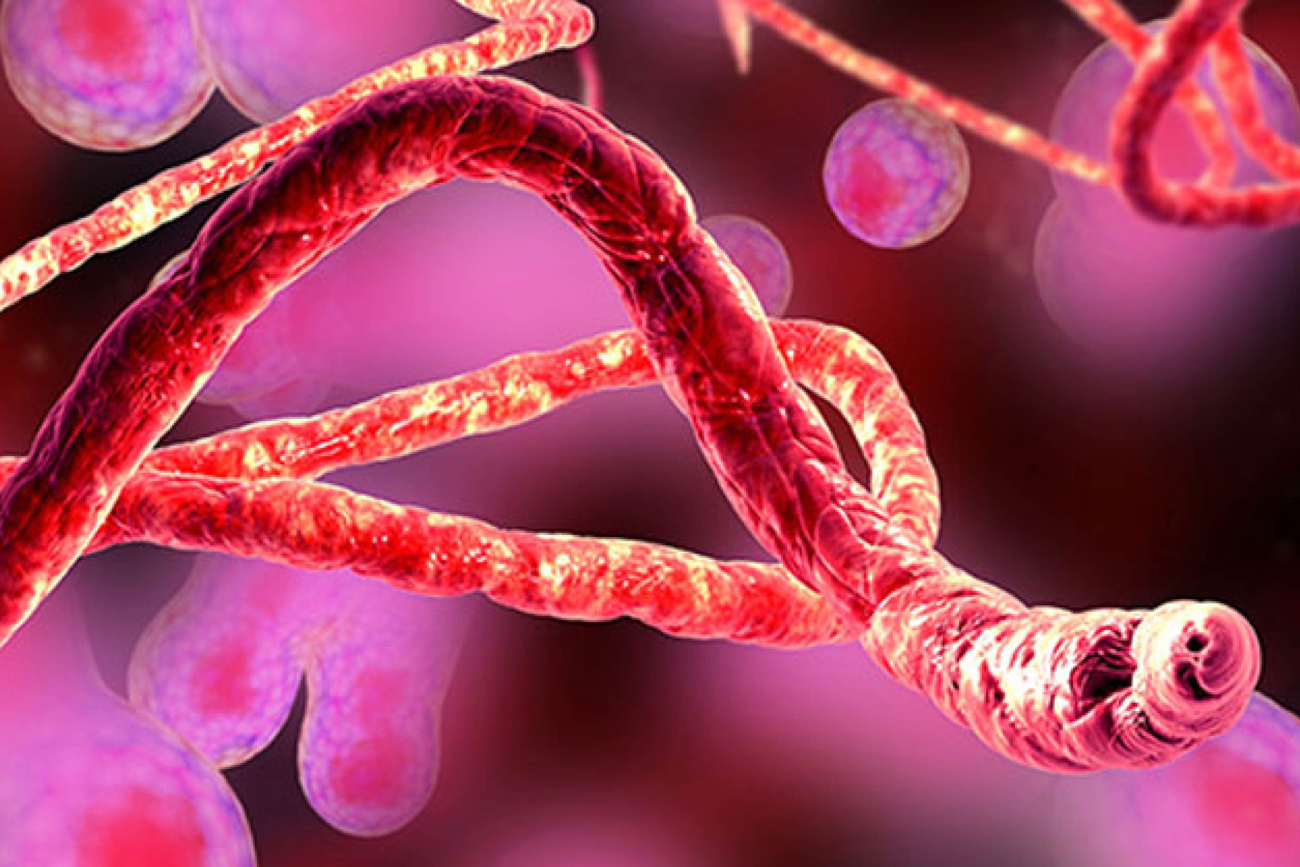 Ebola